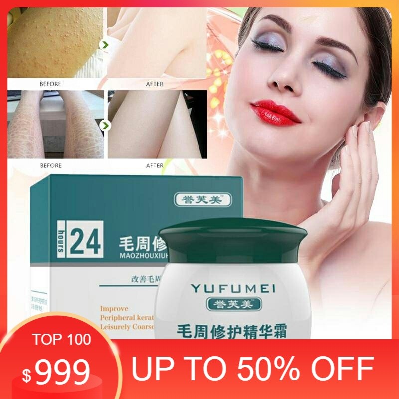 sale YUFUMEI face body Curing Skin kulit ayam Keratosis Skin Repair Chicken skin Pilaris acne jerawa