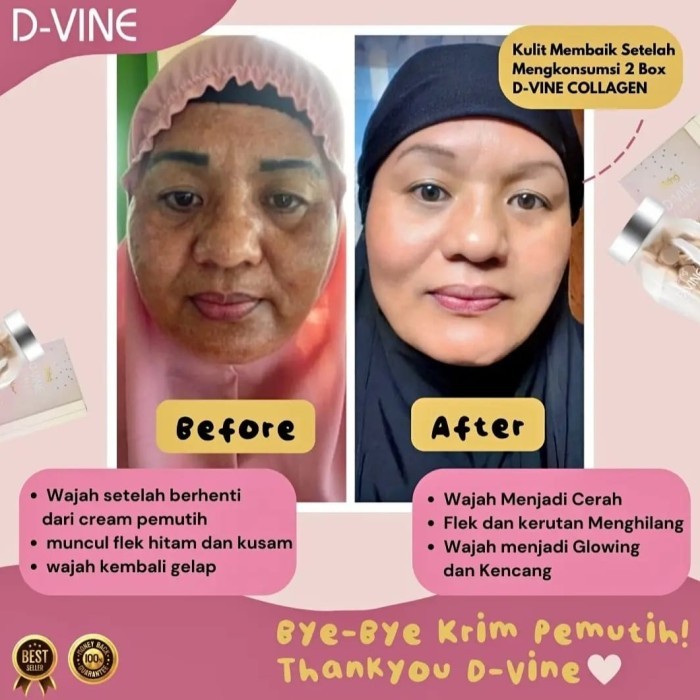 D vine Collagen Eceran 30 butir Collagen Untuk Memutihkan Tubuh