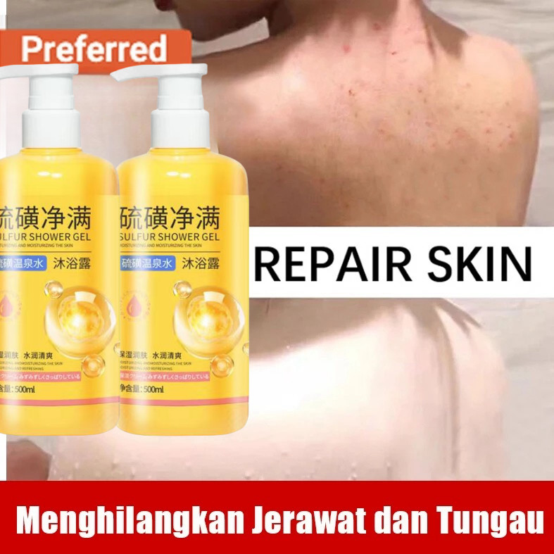 Eczema body wash 500ml Obat gatal gatal kulit Pengobatan Eksim psoriasis eksim kering Kurap gatal ku