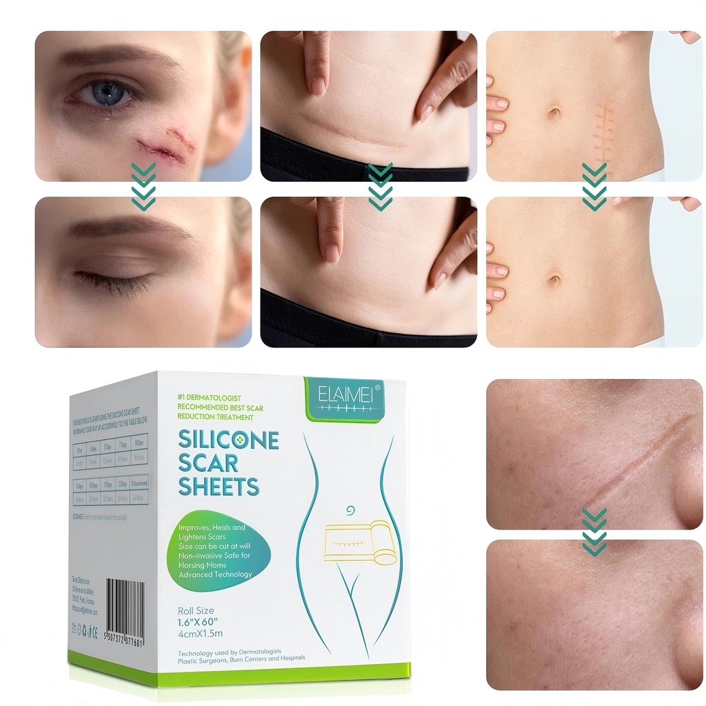 ELAIMEI Silicone Scar Sheets Gel Plester Silikon Penghilang Bekas Luka Keloid Stretch Mark Penghapus