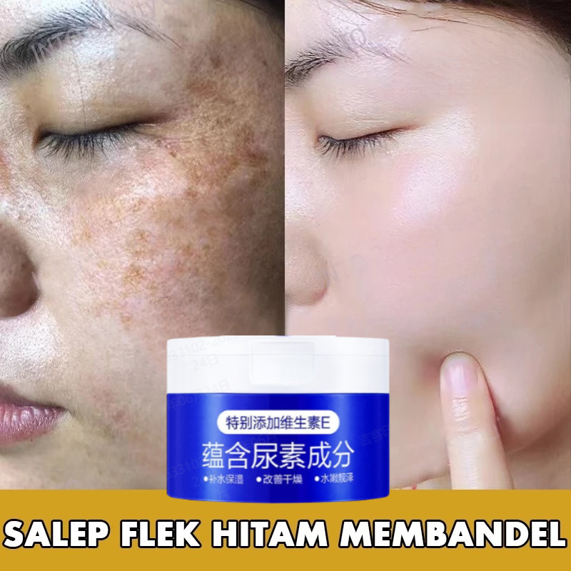 【Kirim dalam 24 jam】Krim Penghilang Flek Hitam Cream Flek Hitam Membandel Salep Flek Hitam Membandel