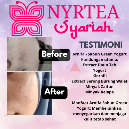 Amerta.kdr - Nyrtea Arnifa Green Yogurt Soap - Sabun Wajah Alami dengan Klorofil dan Sarang Burung W