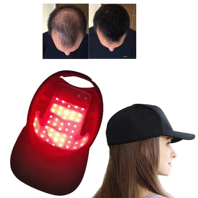 Topi Helm Laser Penumbuh Rambut Alat Terapi Cahaya Penumbuh Rambut