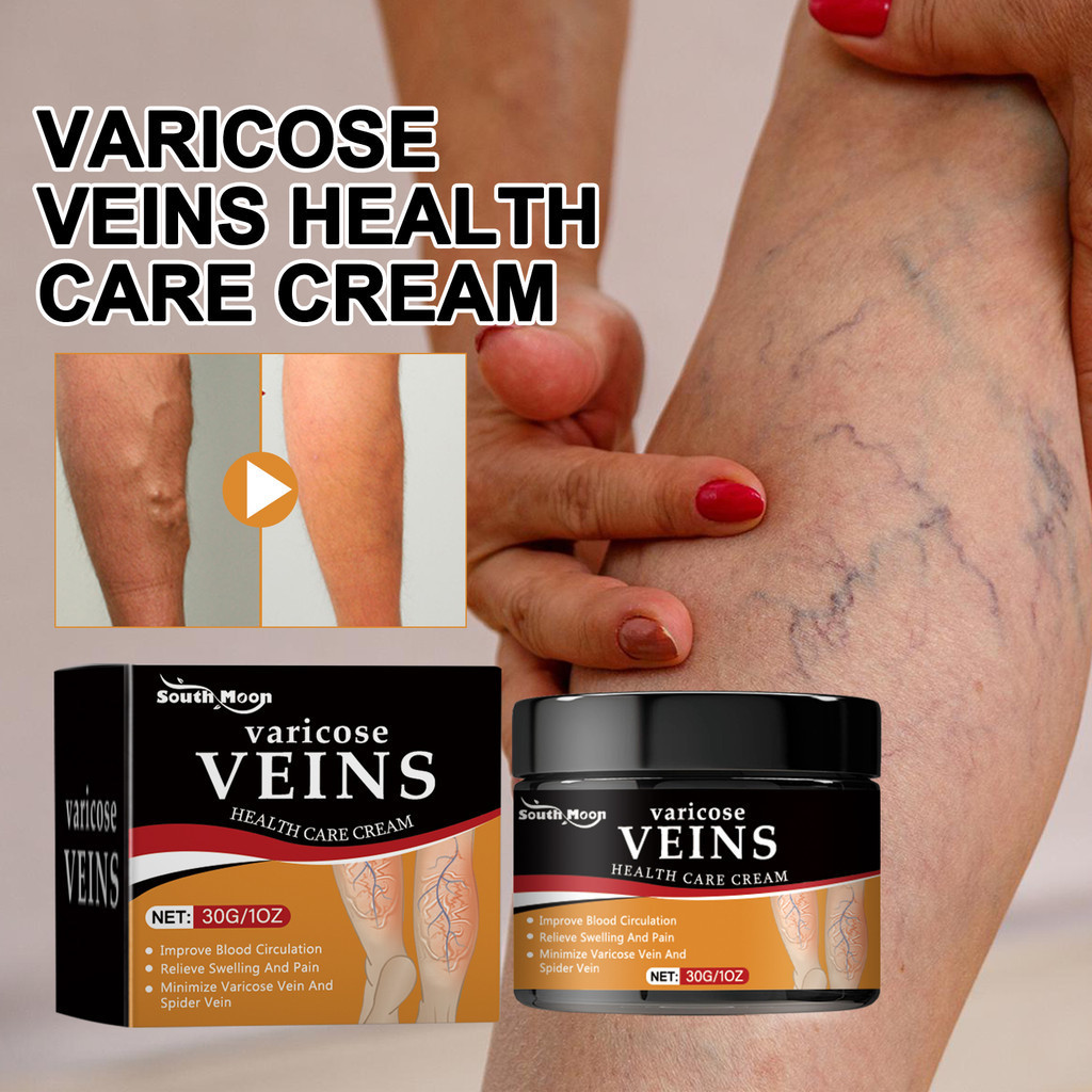 ORI SOUTH MOON VS EELHOE Krim Varises Semprotan Varises Mengurangi Varises Spray Pengobatan Varises