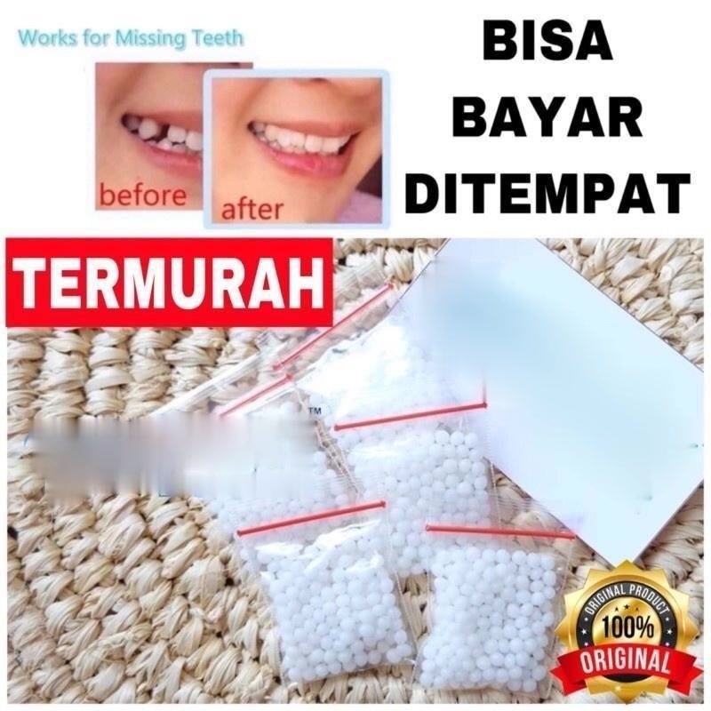 [COD/Instan] - GIGI PALSU 100 BUTIR PENAMBAL GIGI PATAH RENGGANG TEMPORARY TOOTH TEMPTOOTH GINGSUL P