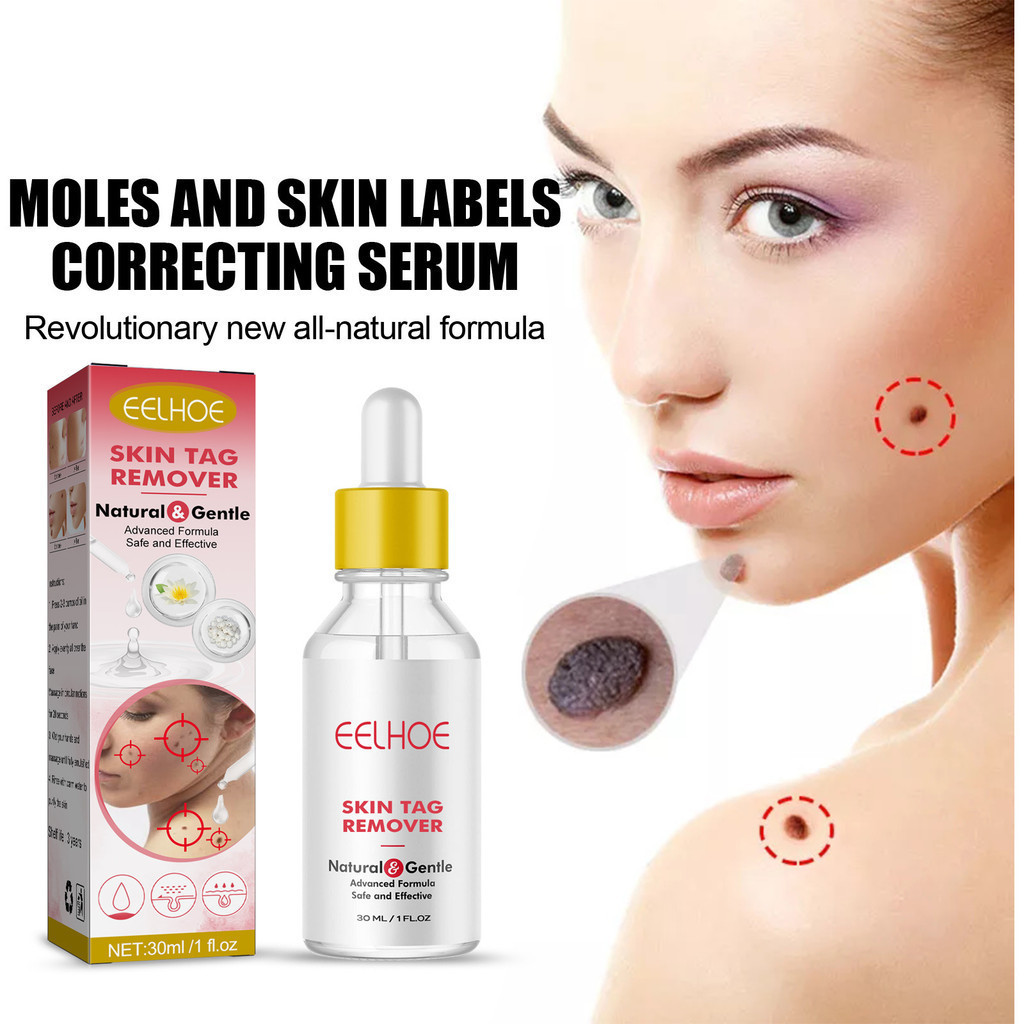 EELHOE Skin Tag Remover 30ml Moles Skin Labels Correcting Serum Warts Removal Essence Painless Flat 