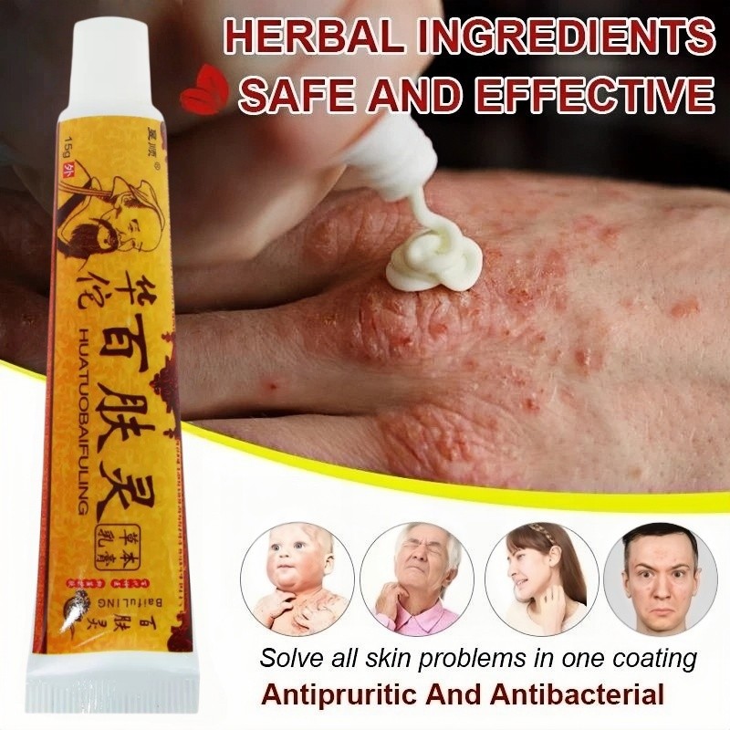 Salep Original Psoriasis Eksim Jamur Kurap Alergi Kulit Cream Cina Obat Gatal bayi Anak-Anak balita 