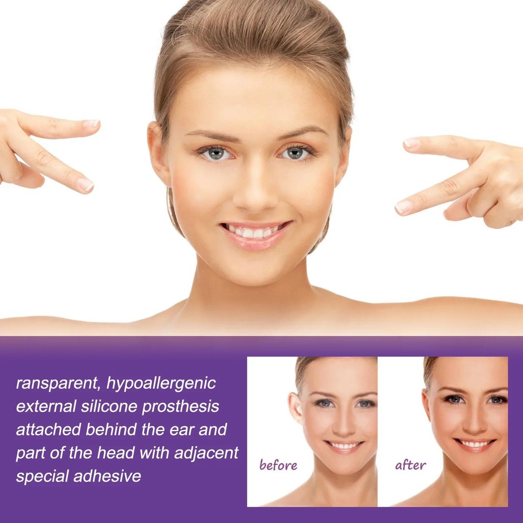 Oranebeauty 6-Pcs/Box Penutup Telinga Penutup Telinga Perbaikan Telinga Koreksi Penutup Telinga