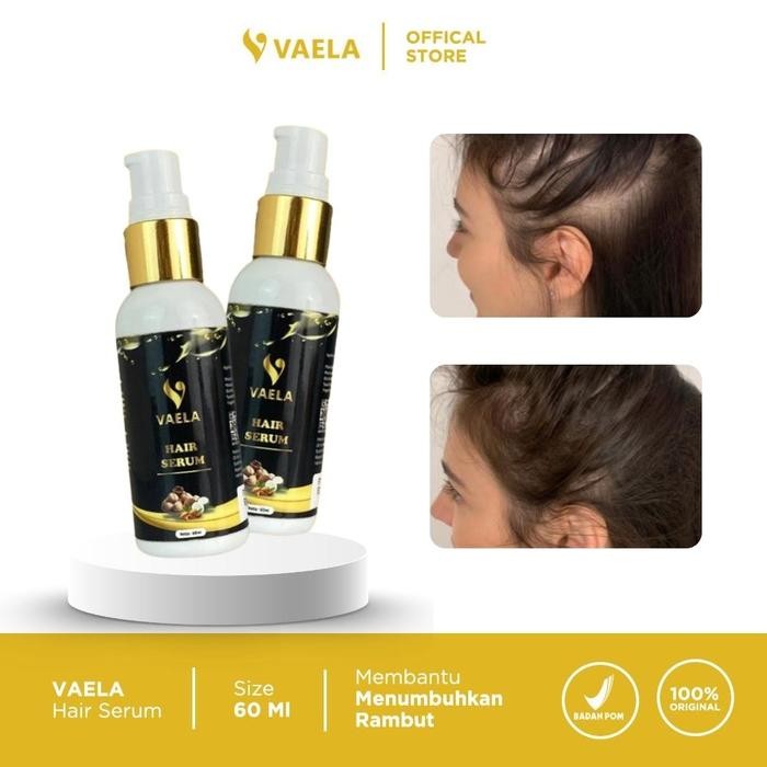 Vaela Hair Serum – Penumbuh & Penebal Rambut Instan | Treatment Haircare untuk Rambut Rontok, Botak,