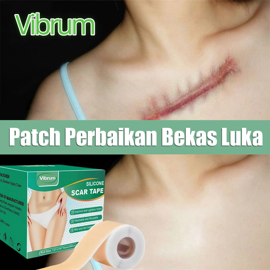Vibrum Dermaline Silicone Keloid 1Roll Keloplast Silicone Keloid Plester Scar Tape Keloid Bekas Luka