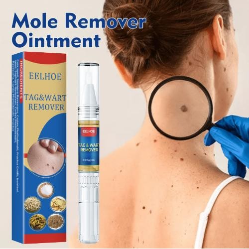 

obat kutil papiloma di leher, salep penghilang kutil Wart Remover cream Krim Penghilang Lalat, Krim Penghilang Kutil, Mudah Dibawa Untuk Semua Kulit, Krim Penghilang Kutil borneo store