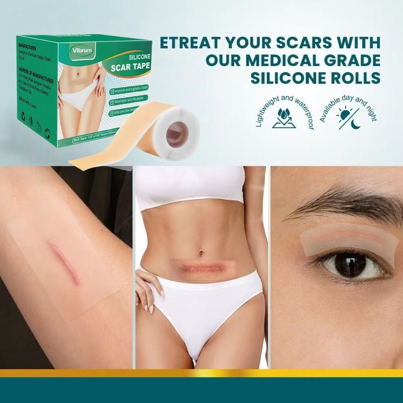 Vibrum Dermaline Silicone Keloid 1Roll Keloplast Silicone Keloid Plester Scar Tape Keloid Bekas Luka
