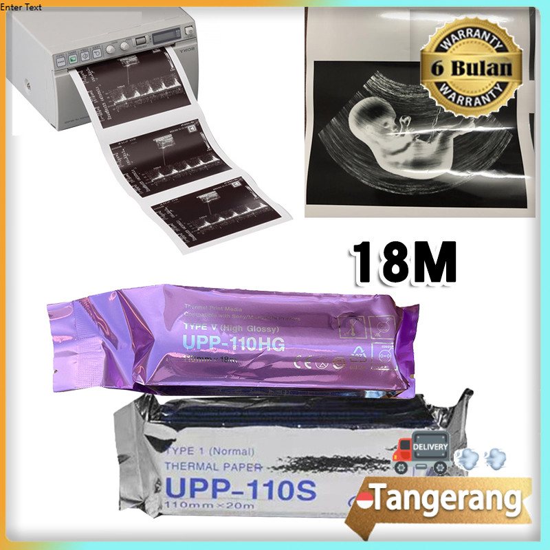 

Kertas Usg / Kertas Usg Sony / UPP-110HG / Usg Sony / Sonomed 110mm x 18m