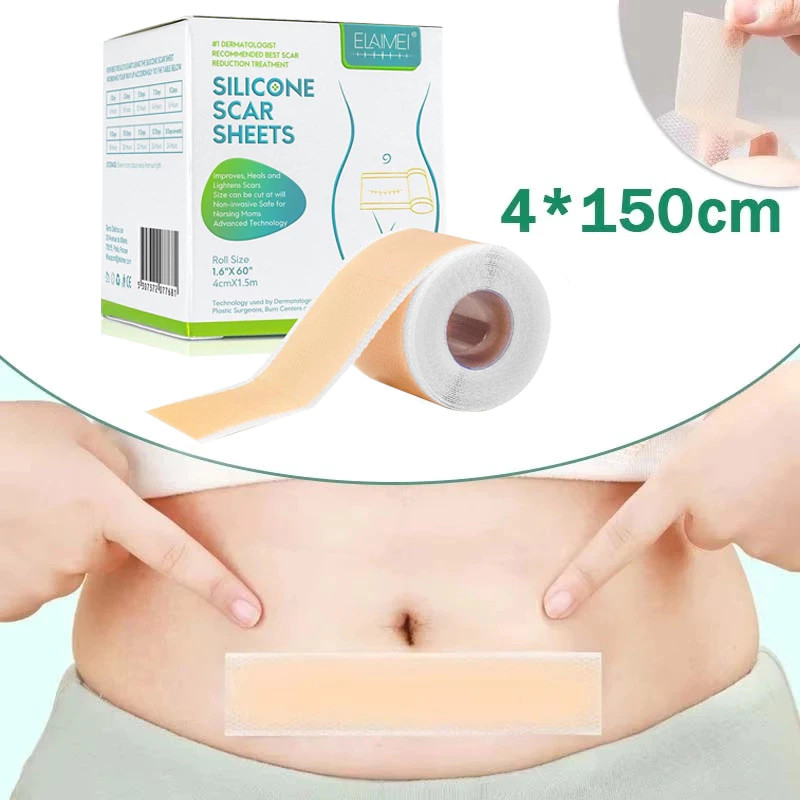 Elaimei Silicone Scar Patch Roll 4*1.5M Remove Acne Burn Treatment Cover Tape Roll Waterproof Cod