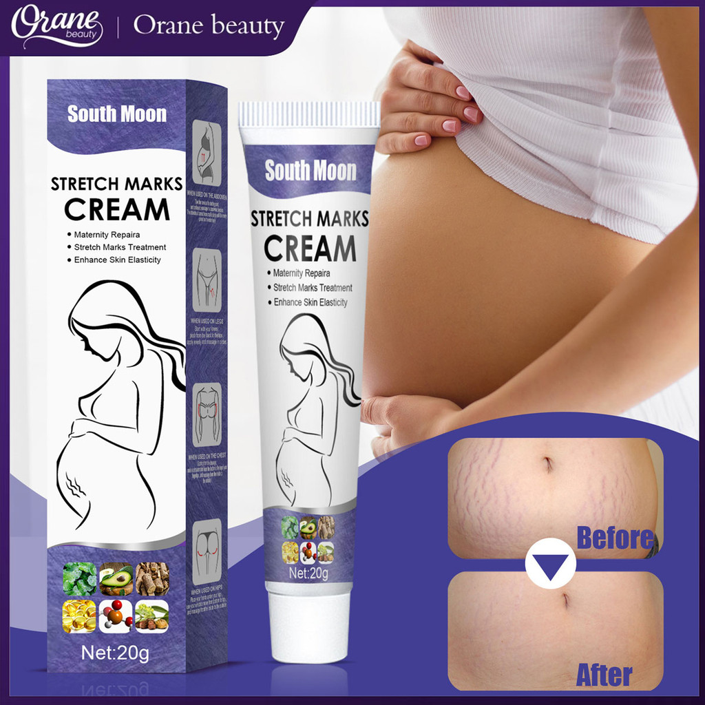 Oranebeauty 20g/box Penghilang Stretch Mark Permanen Krim Penghilang Stretch Mark Penghilang Stretch