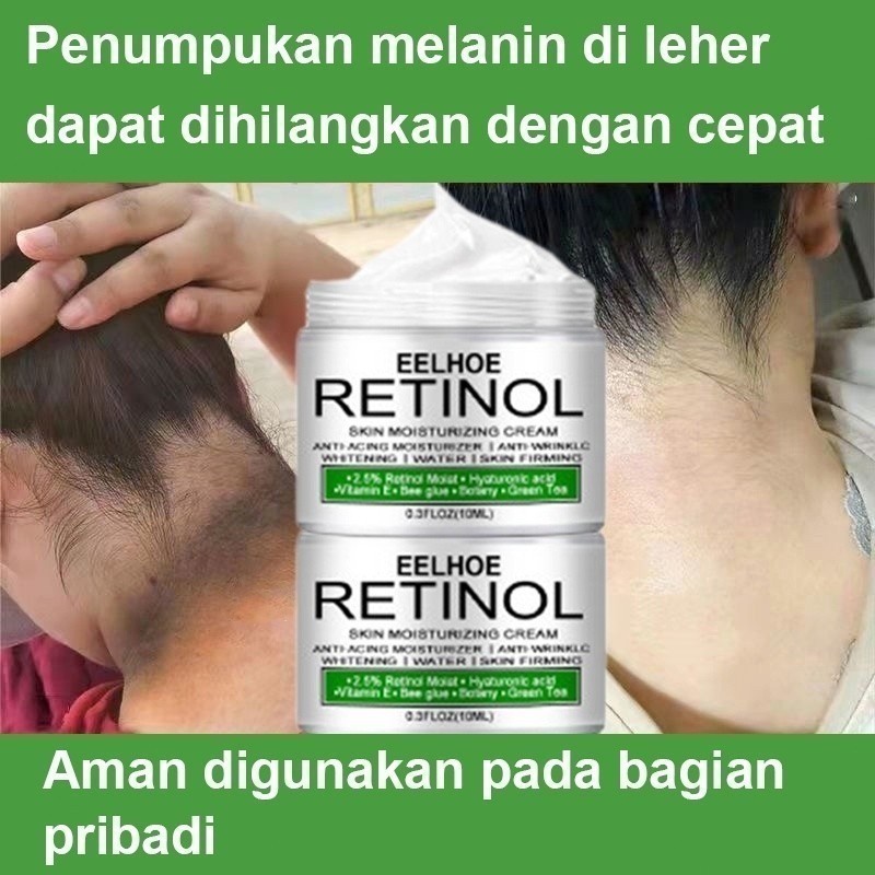 Krim Pemutih Ketiak Pemutih Selangkangan Vagina Pembersih Selangkangan Hitam Krim Pemutih Ketiak Pem