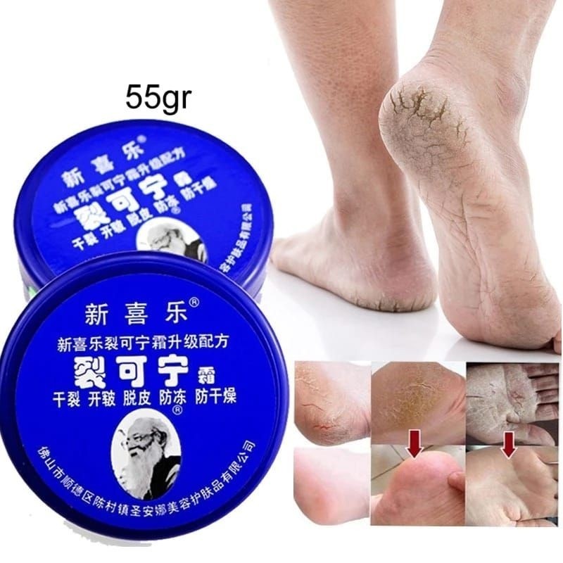 SALEP HERBAL TUMIT PECAH TUMITKU MENGATASI KAKI PECAH KERING KAPALAN INSTAN TmaxBeauty