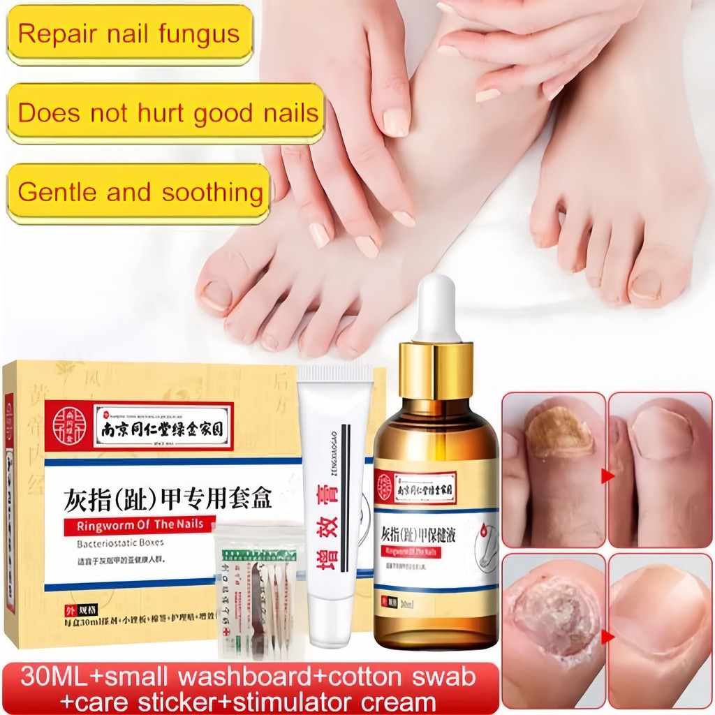 Nail Repair Essence Serum Perawatan Kuku Berjamur Serum Penghilang Jamur Di Kuku Vitamin Kuku Rusak 