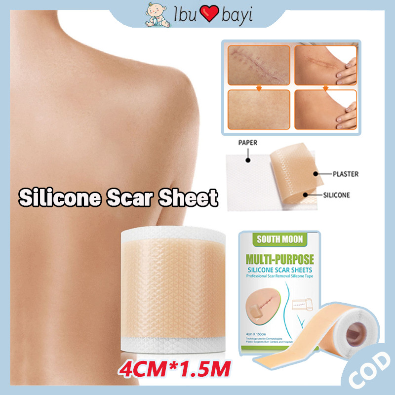 Silicone Scar Sheet / Perawatan Keloid Operasi Stretch Mark Plester Silikon Penghilang Keloid Bekas 