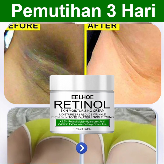 Krim Pemutih Ketiak Pemutih Selangkangan Vagina Pembersih Selangkangan Hitam Krim Pemutih Ketiak