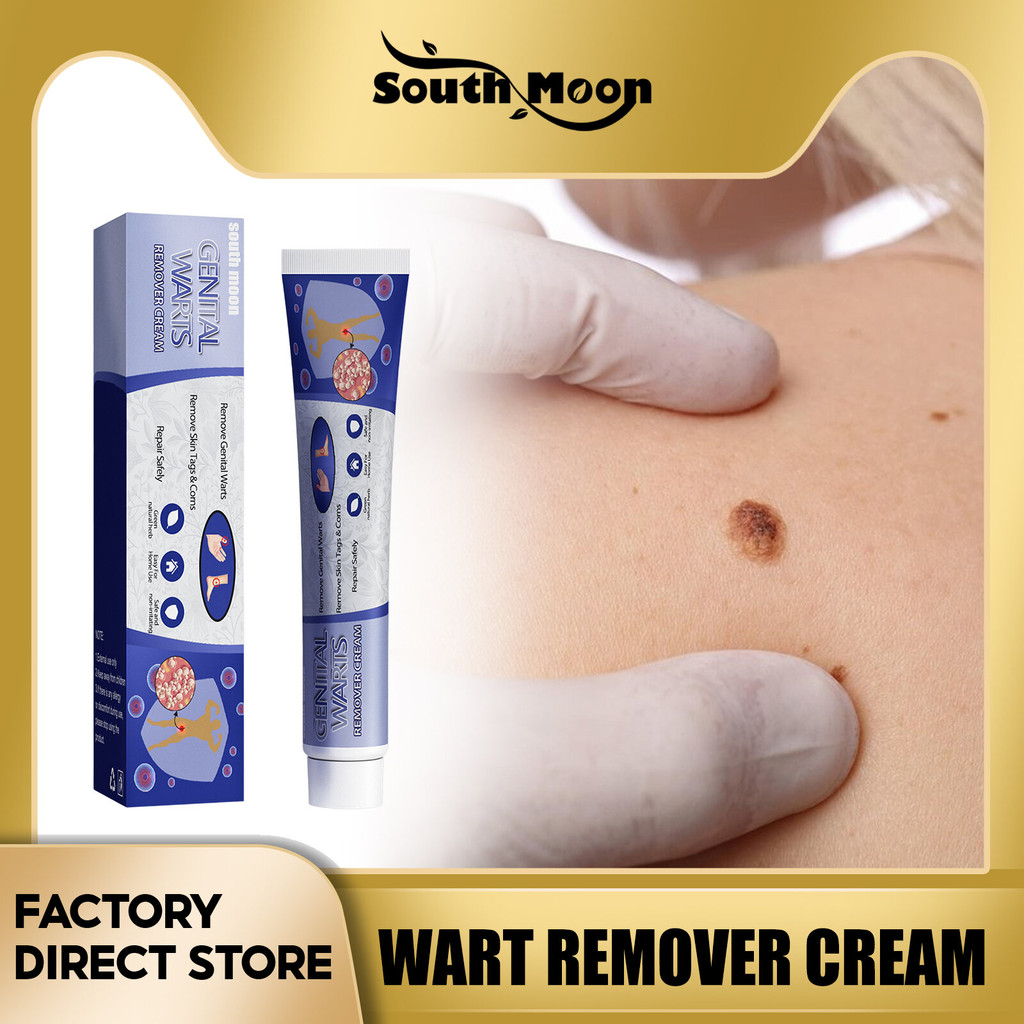 Free Shipping 【Hot Sale】South Moon Wart Remover Cream Painless Wart Treatment Cream Skin Tag Remover