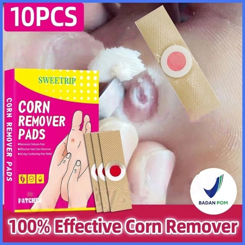 100% ORI 10pcs Plester Mata Ikan Paling Ampuh Obat Mata Ikan Penghilang Mata Ikan Plester Kutil Dan 