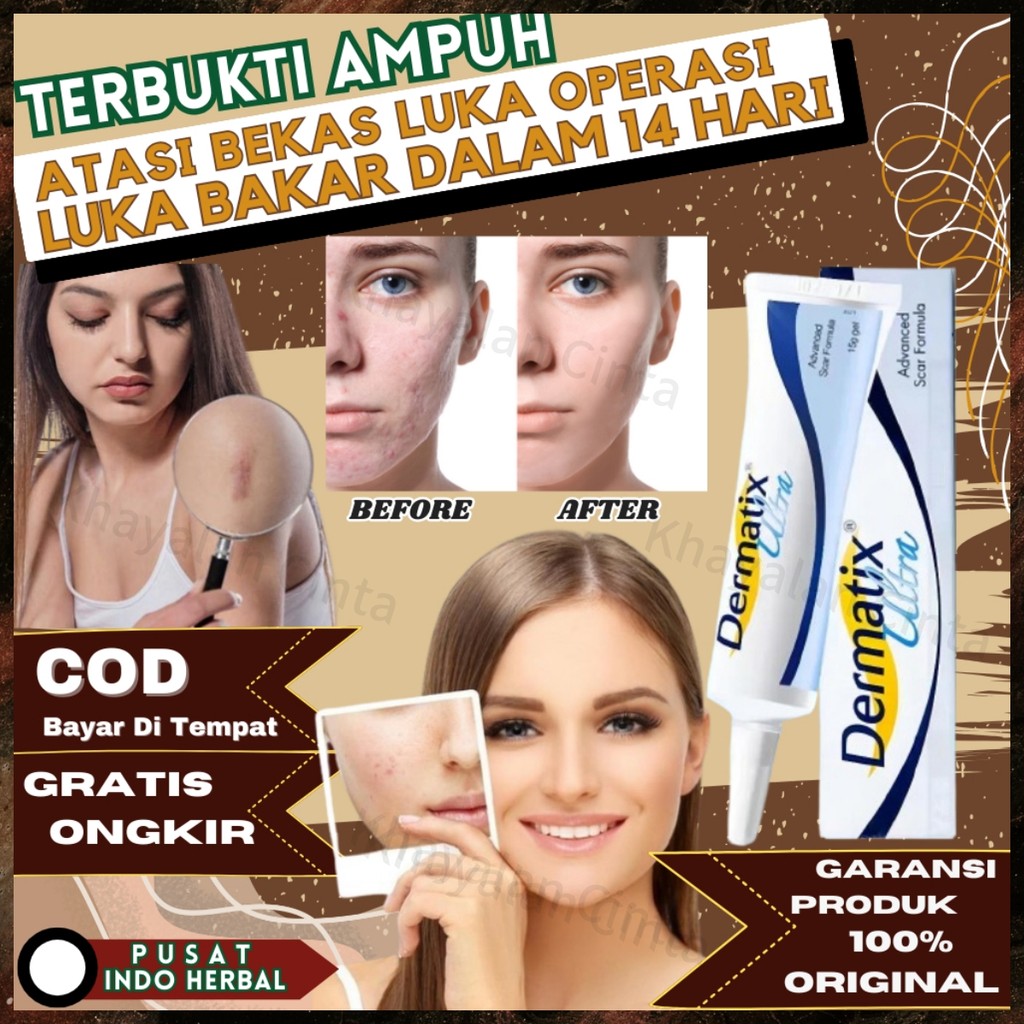 【COD】Dermatix Ultra 15gr 100% Original