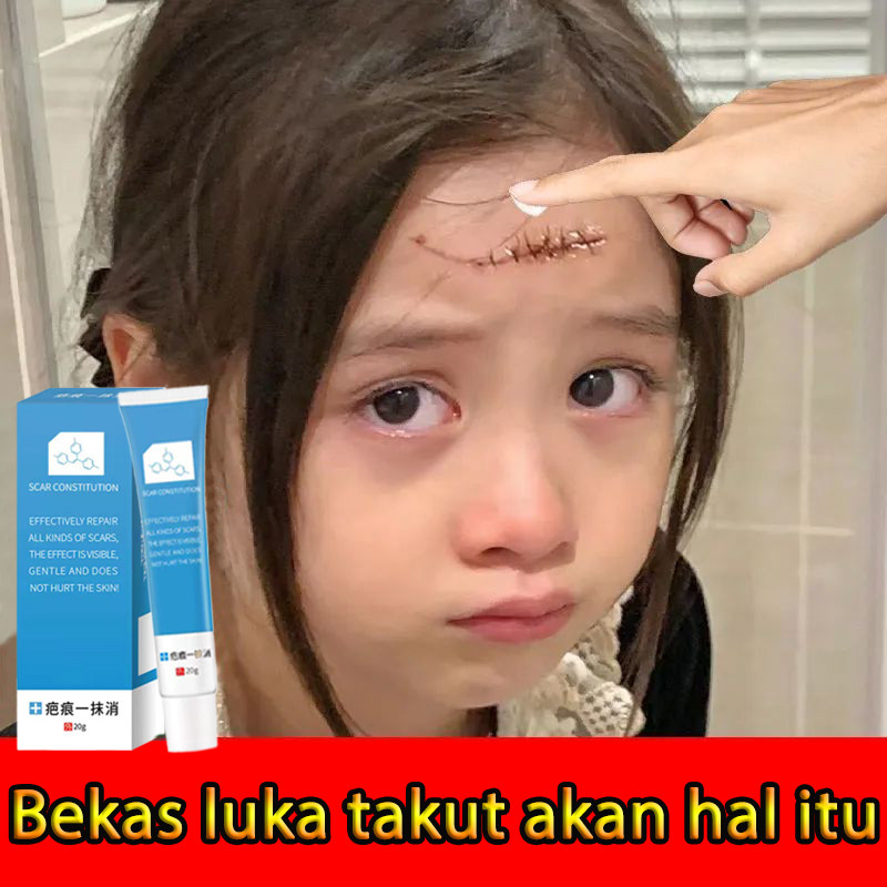 50%OFF COD-Cream Penghilang Bekas Luka/Salep Penghilang Bekas Luka/Krim Penghilang Bekas Luka/salep 