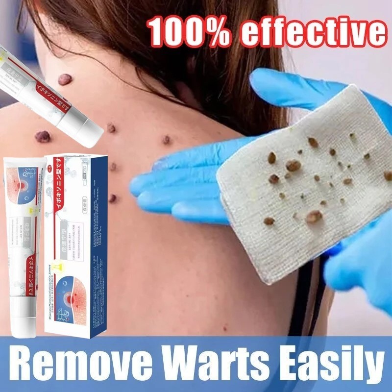 Obat penghilang tahi lalat Obat penghilang kutil Obat kutil kelamin Penghilang kutil dan tahi lalat 