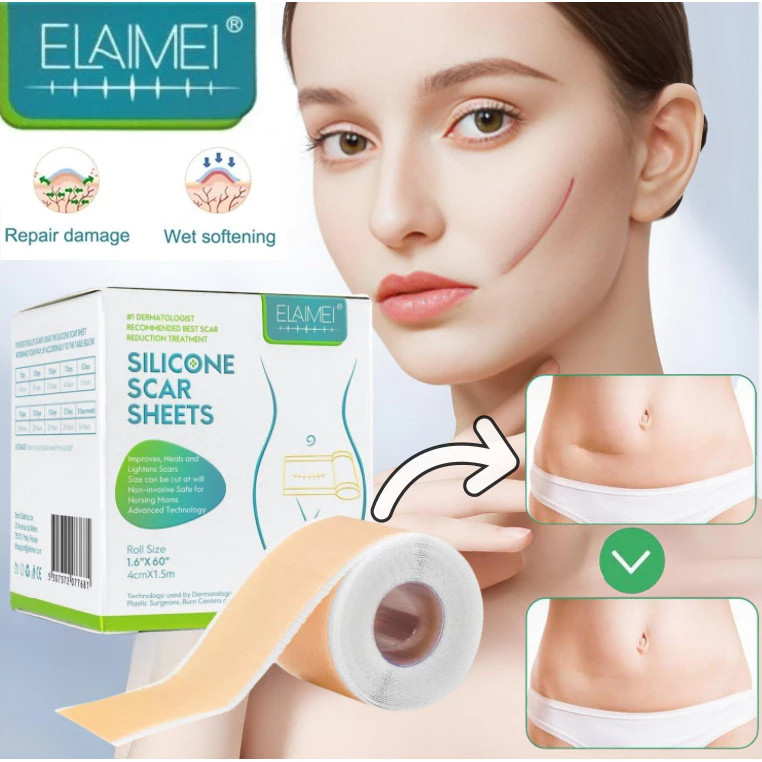 4CM*1.50CM ELAIMEI Silicone Scar Sheet Plester Penghilang Bekas Luka Stretch Mark Penghapusan Scar S