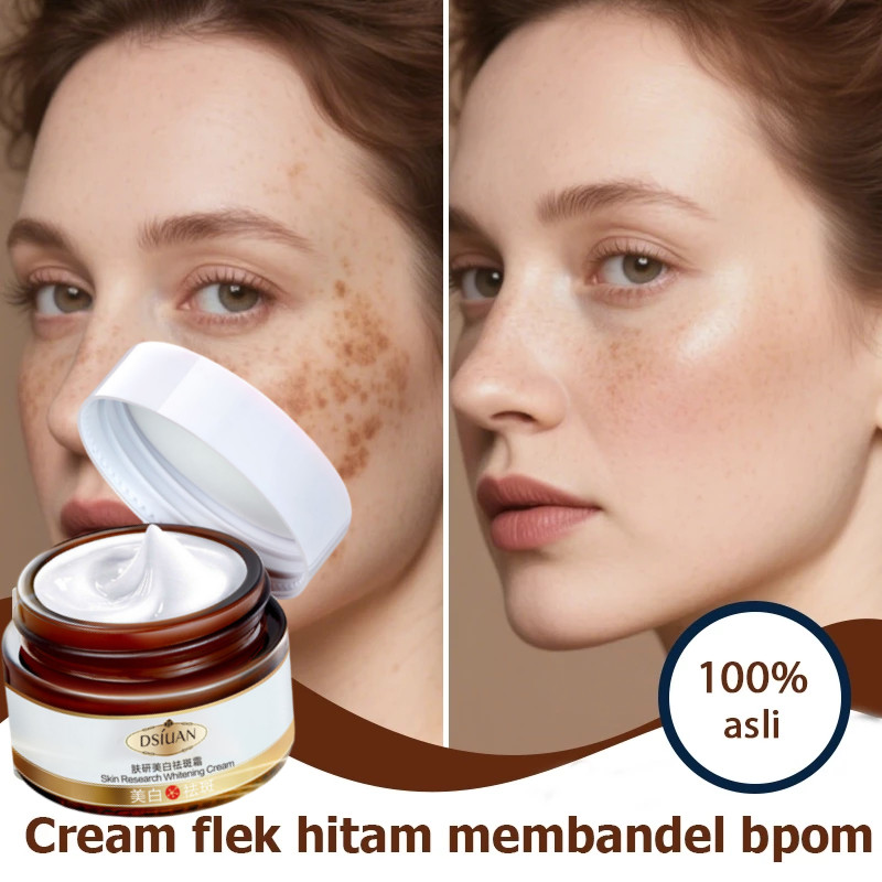 [BPOM]penghilang flek hitam membandel flek hitam di wajah membandel cream flek hitam membandel 30g p