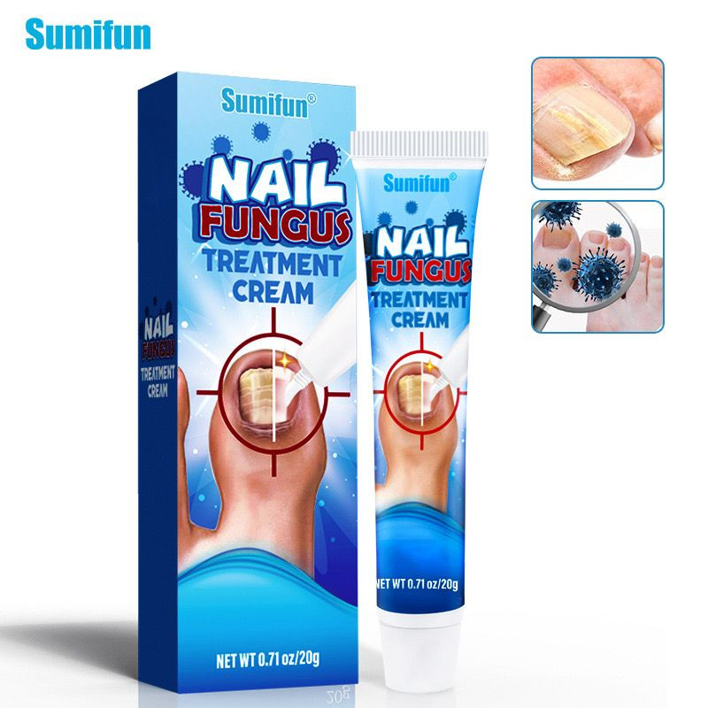 Sumifun Cream Obat Salep Jamur Kkuku - Salep Kuku Jamuran | Salep Perawatan Kuku - Anti Feksi Jari K