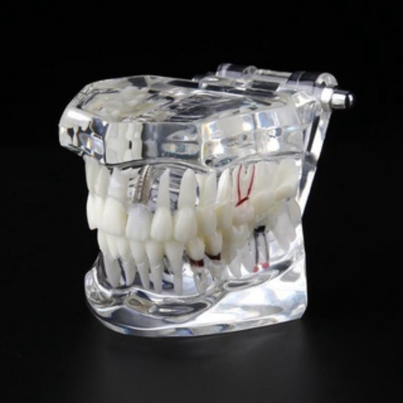 DentCure Duradent model gigi Dental Study Model Phantom Gigi bisa di lepas transparan