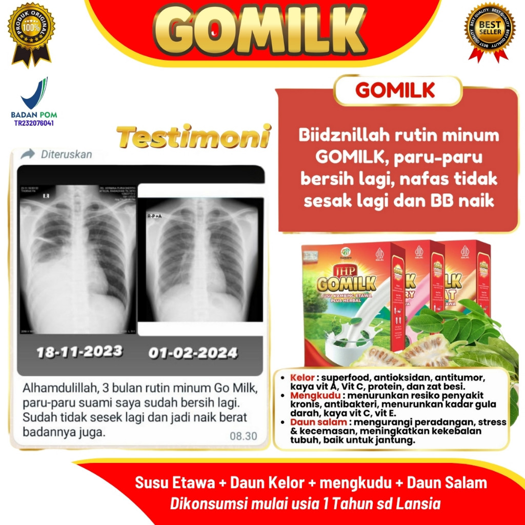 

Susu Kambing Etawa GOMILK 200gr – Herbal Daun Kelor, Nafsu Makan Anak, Tulang, Imun, TBC, Maag