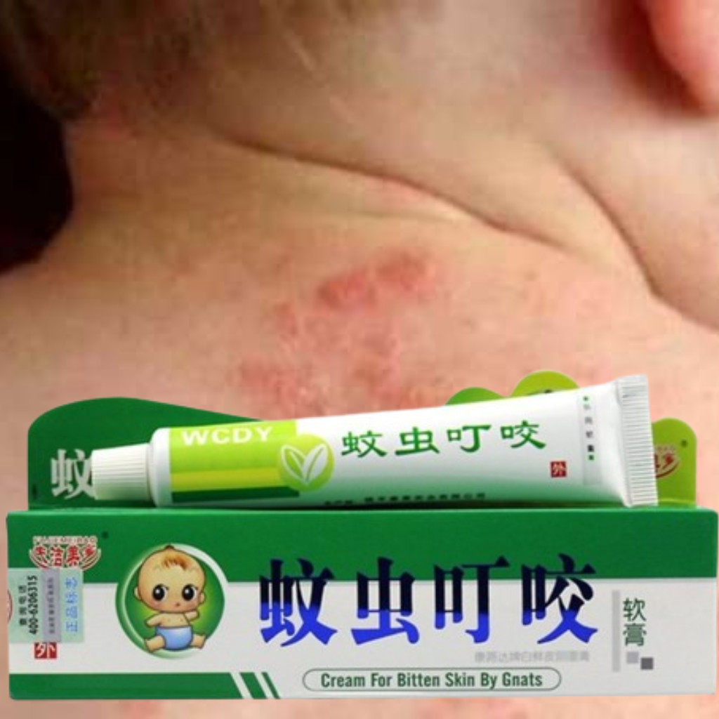 Salep Kulit Gatal  Kuman Jamur Buat Bayi Anak Obat Bintik Merah Ruam Popok Biangkeringat Gatel Scabi