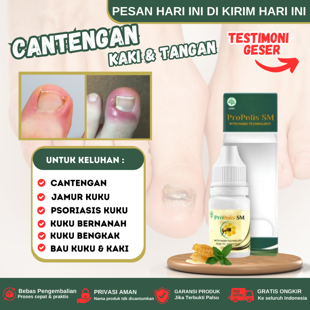 Obat Cantengan Jempol Kaki, Tetes kuku bau busuk, Obat Psoriasis Kuku berjamur bernanah