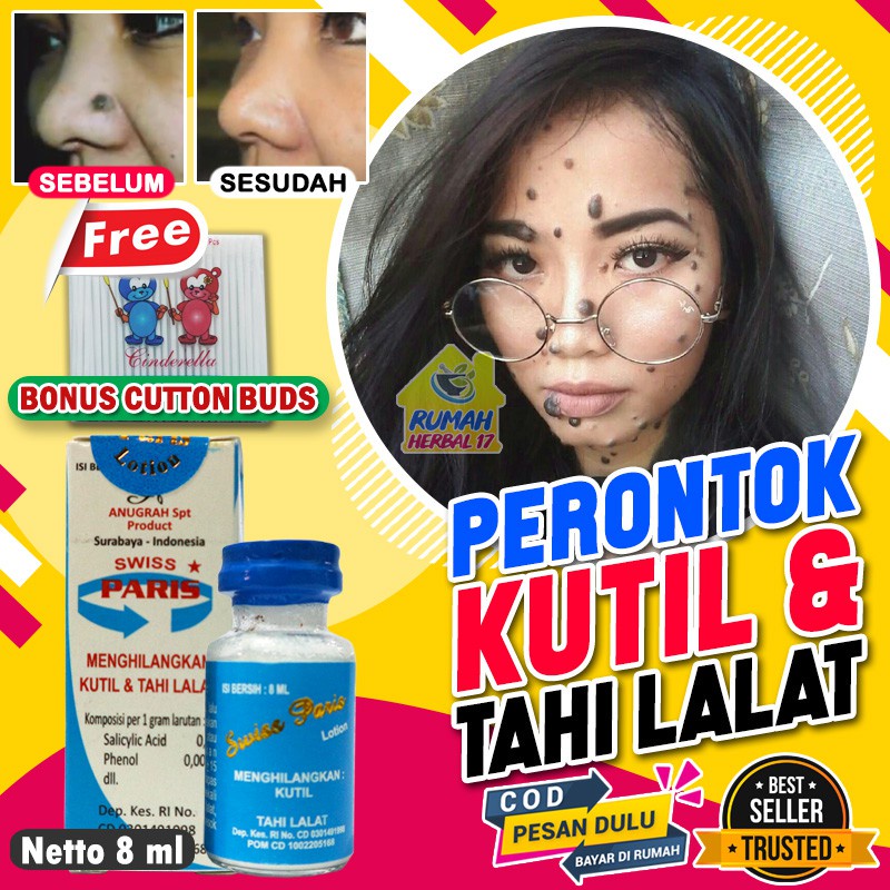 Swiss Paris Lotion Original - Obat Penghilang Tahi Lalat Dan Kutil Alami Tanpa Operasi