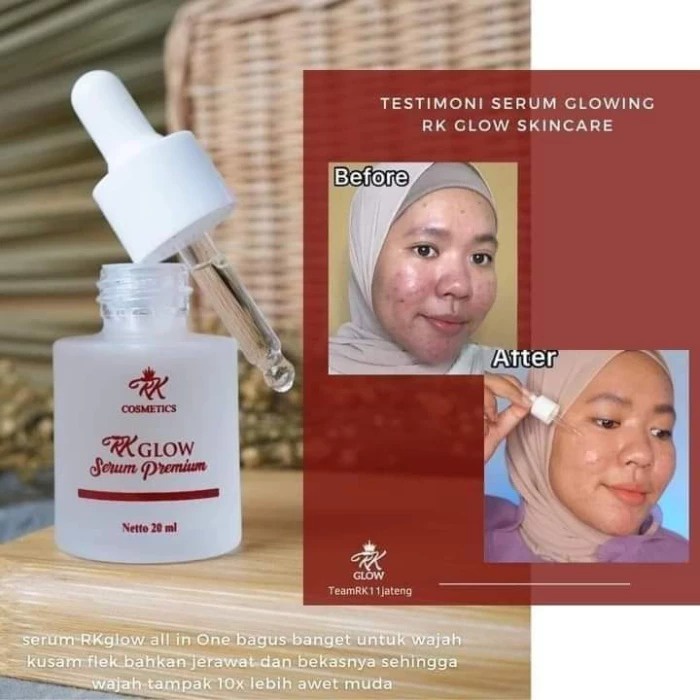 (BARNIK) SERUM RK GLOW 100% Original | Serum Wajah Cerah | Brigtening Serum RK