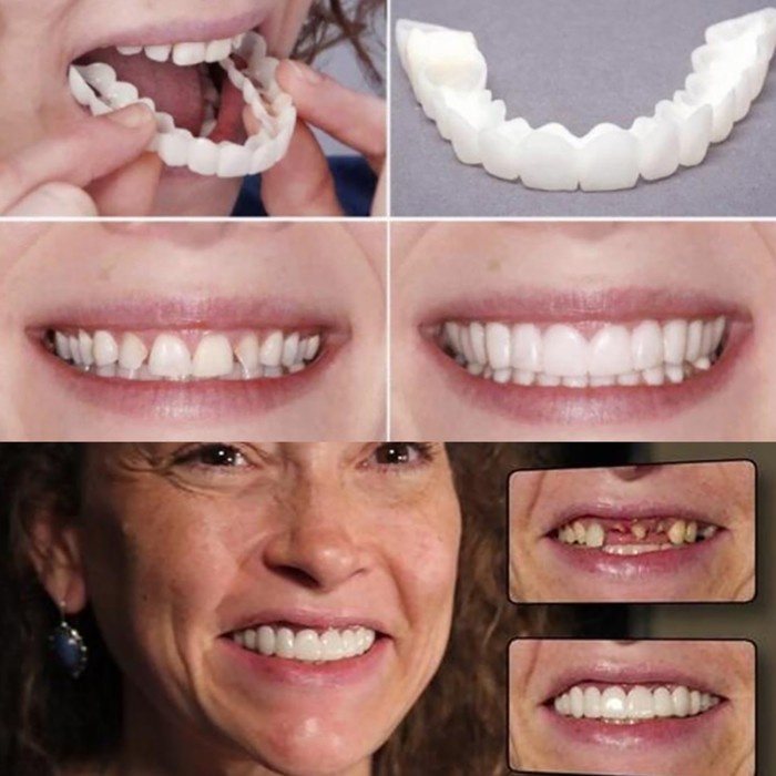 1 Pasang Gigi Palsu Instan Snap on Smile Atas Bawah Penutup Ompong