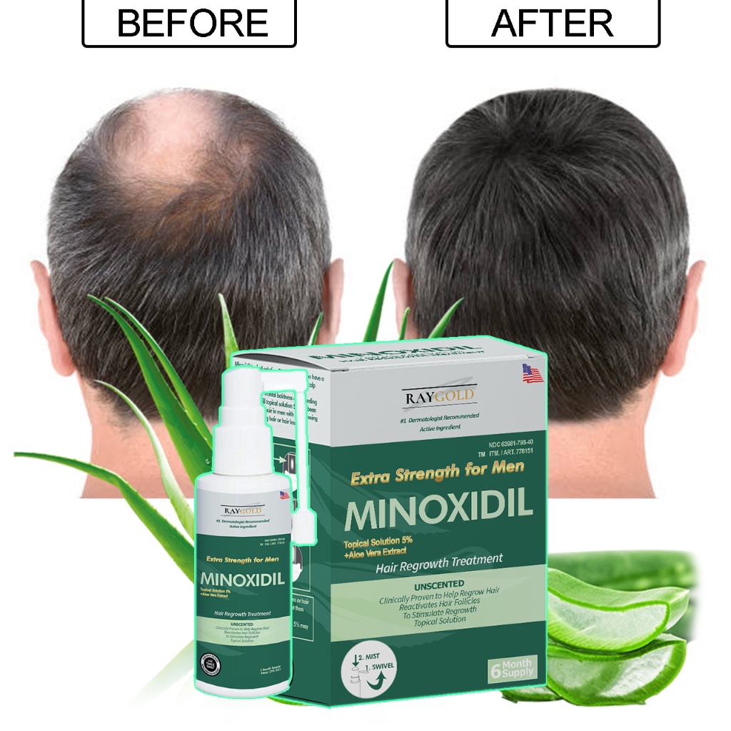 MINOXIDIL 5% penumbuh rambut & brewok with Aloe Vera for MEN made in USA - RAYGOLD - anti rontok & k