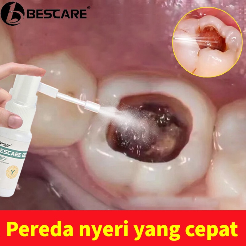 COD obat sakit gigi - obat sakit gigi berlubang ampuh - obat sakit gigi berlubang 20ML obat sakit gi