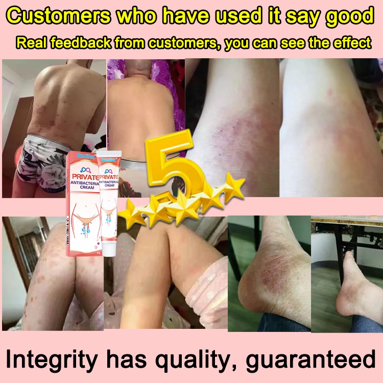 [Whispers] Salep Gatal Selakangan HPV Private Obat kurap Obat Kutil Kelamin HPV, Salep Obat Penyakit