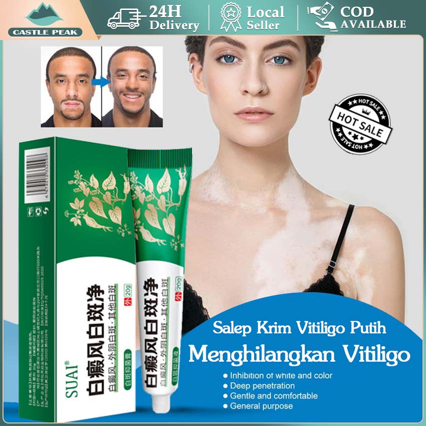 Cream Vitiligo 100 % Original / Salep Obat Vitiligo / Vitiligo Obat Salep Penyakit Kulit - Bercak Pu