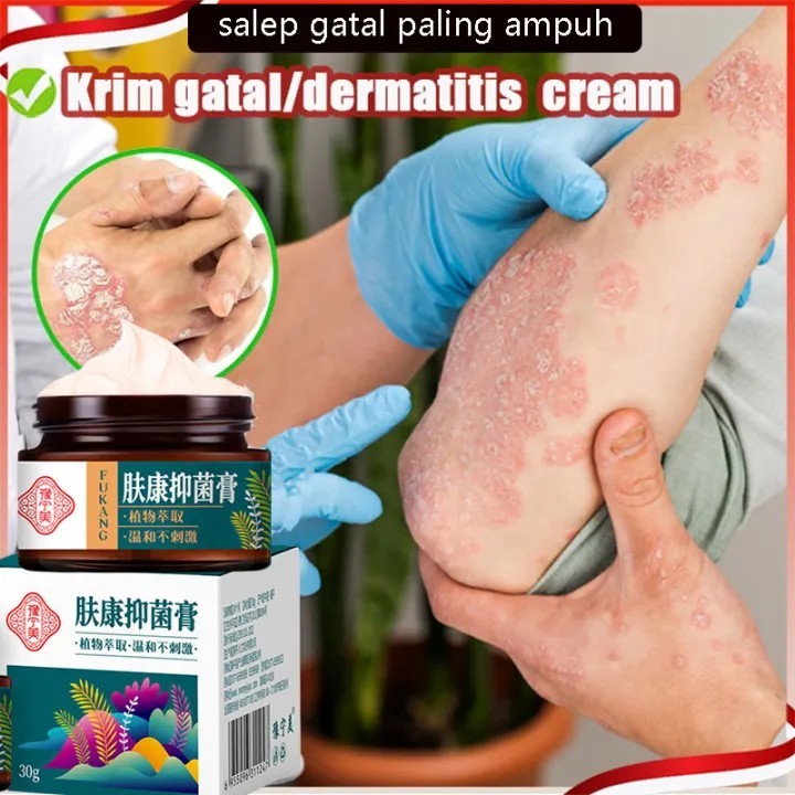 Salep gatal paling ampuh salep gatal obat gatal selangkangan obat selangkangan gatal dan hitam obat 