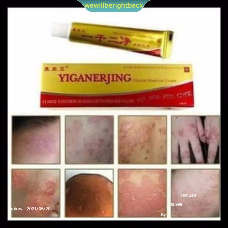 obat cina tradisional penyakit kulit dermatitis Anti bakteri kudis original