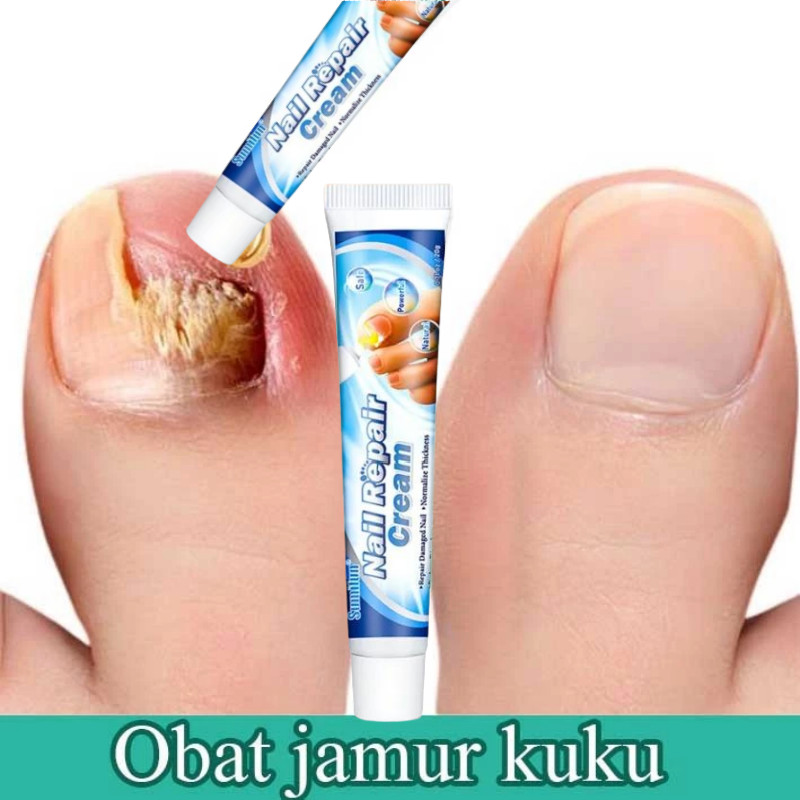 obat jamur kuku Perawatan Jamur Kuku Paronychia Perawatan Lumut Kuku Pemutih Kuku Penghilang Jamur K