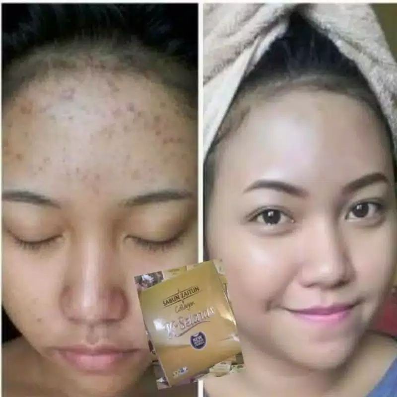 

PROMO BULAN INI !!! SABUN ZAITUN K-SELARAS Original eceran