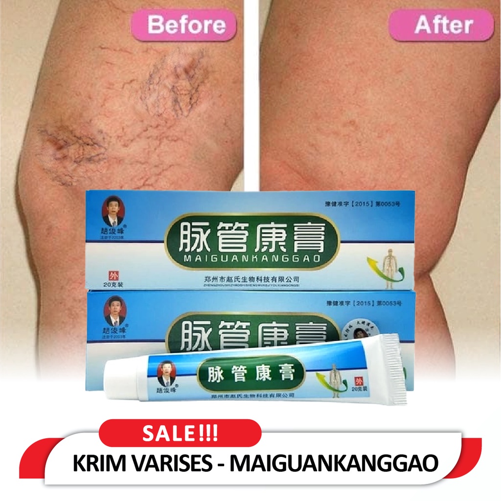 [ ORIGINAL ] MAIGUANKANGGAO SALEP OBAT CHINA KRIM SANGAT AMPUH MENGHILANGKAN VARISES KAKI