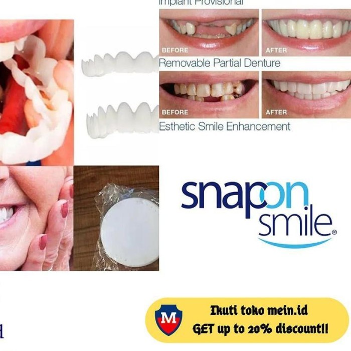 BARU SNAP ON SMILE ORIGINAL 100% / BEST GIGI PALSU SEPASANG Veneer