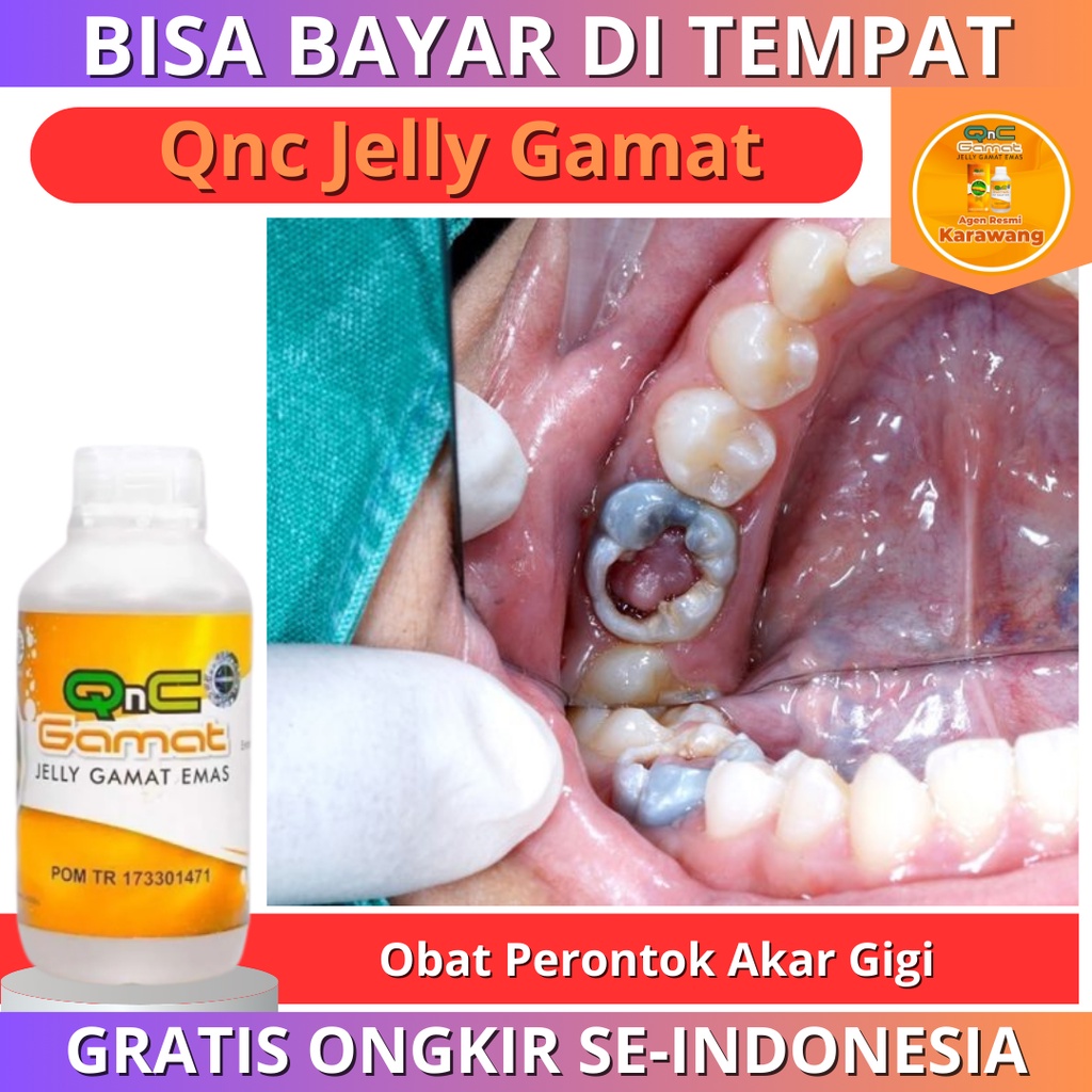 Obat Perontok Akar Gigi, Obat Pencabut Gigi Berlubang, Obat Agar Gigi Cepat Copot, Obat Perontok Gig